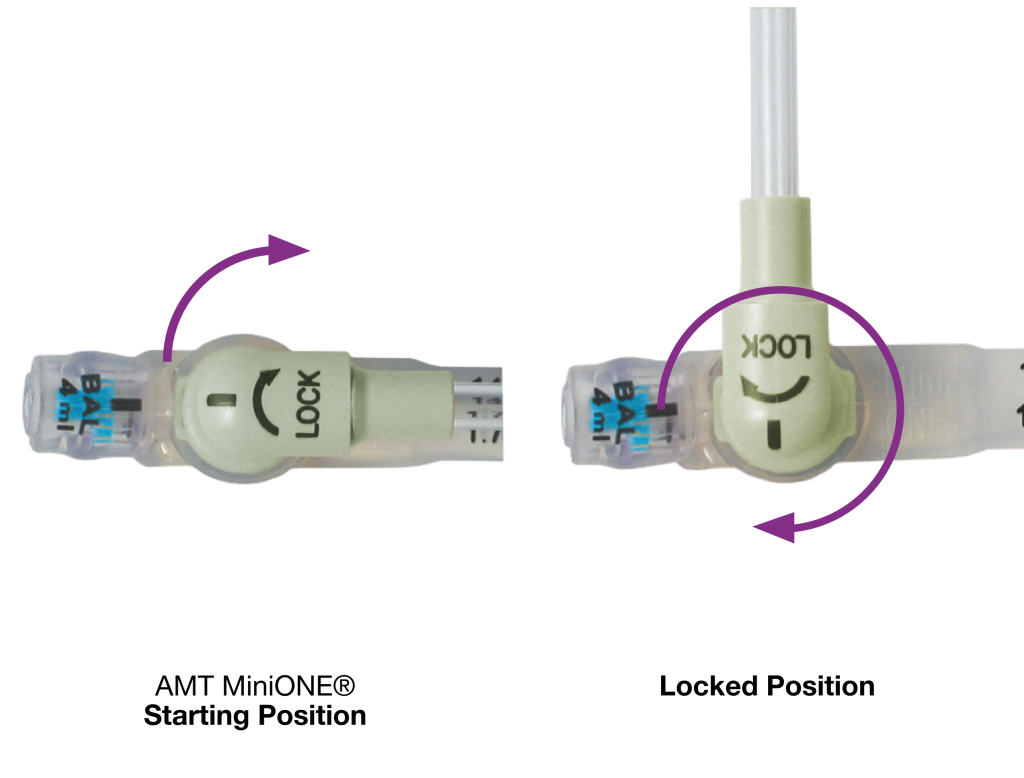 G-tube lock positions