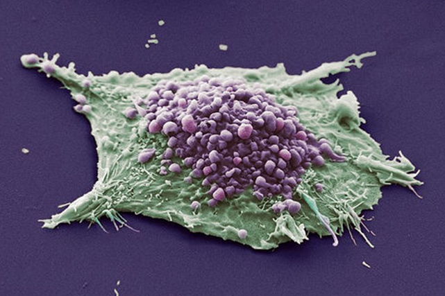 Rendering of a lung cancer cell